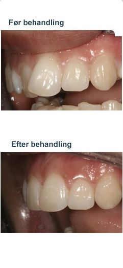 tandregulering